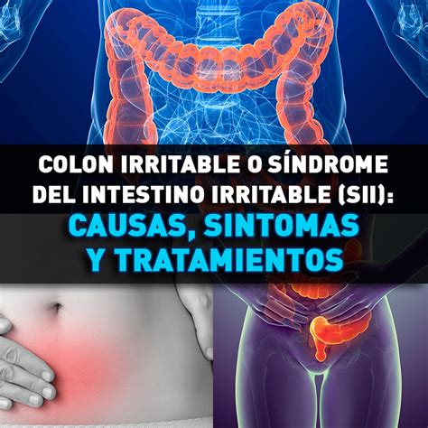 sindrome del colon irritable